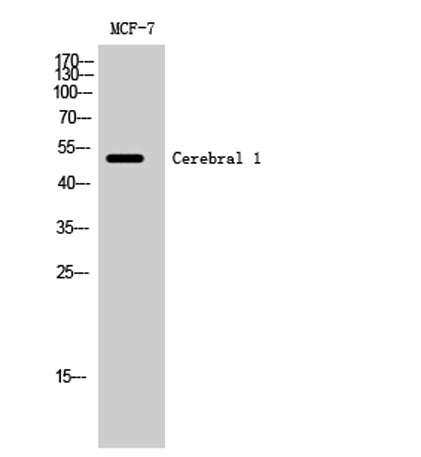Cerebral 1 rabbit pAb