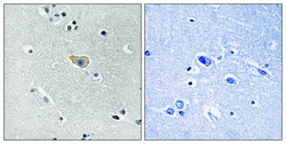 NMDAζ1 (phospho Ser890) rabbit pAb