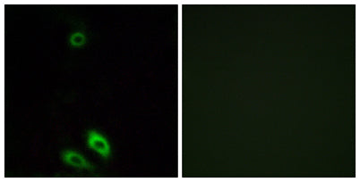 AKR1CL1 rabbit pAb