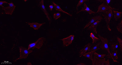 Lck (phospho Tyr393) rabbit pAb
