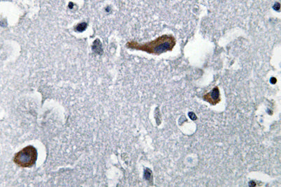 MAP-2 rabbit pAb
