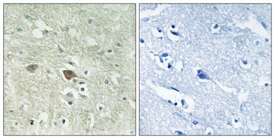 NDUFV3 rabbit pAb