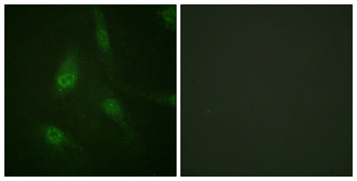 NFATc3 (phospho Ser165) rabbit pAb