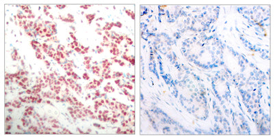 NFκB-p100 (phospho Ser865) rabbit pAb