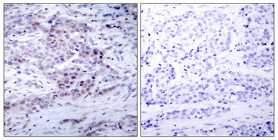 NFκB-p100 (phospho Ser869) rabbit pAb