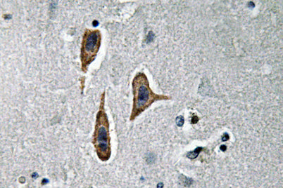 Nephrin rabbit pAb