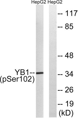 YB-1 (phospho Ser102) rabbit pAb