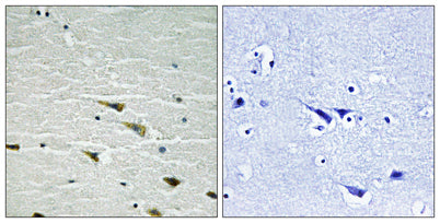 Trk A (phospho Tyr757) rabbit pAb