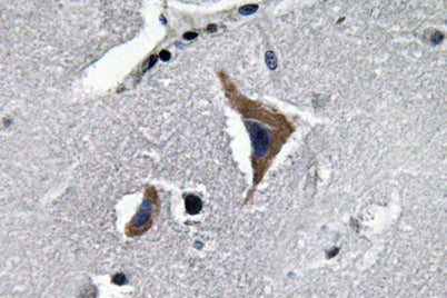 Neurophysin I rabbit pAb
