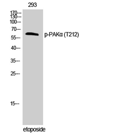 PAKα (phospho Thr212) rabbit pAb