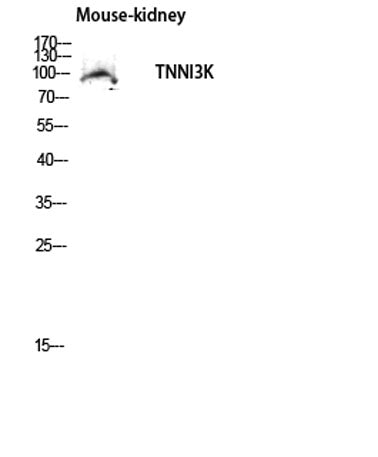 TNNI3K rabbit pAb