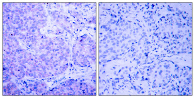 PDHK1 (phospho Ser241) rabbit pAb