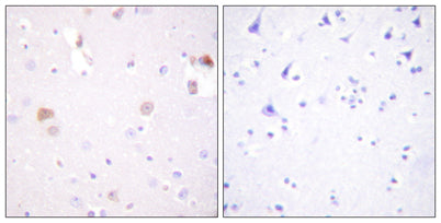PC-PLD1 rabbit pAb