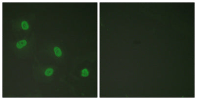 TRAP220 (phospho Thr1457) rabbit pAb