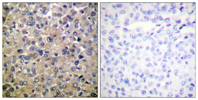 PP1α rabbit pAb