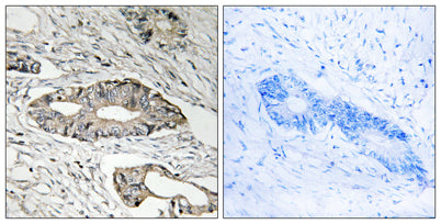 Epsin 3 rabbit pAb