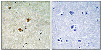 AMPKβ1 rabbit pAb