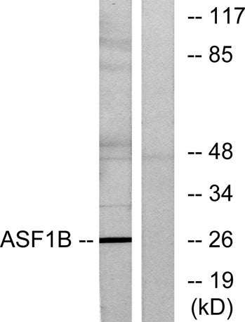 ASF1B rabbit pAb
