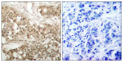 PKC θ (phospho Ser676) rabbit pAb