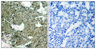 MEK-1/2 (phospho Ser222/226) rabbit pAb
