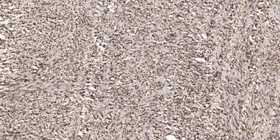 MEK-6 (phospho Ser207) rabbit pAb