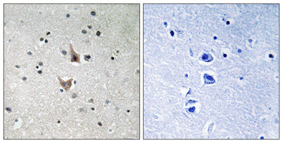 Presenilin 1 (phospho Ser357) rabbit pAb