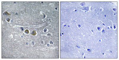 Ribosomal Protein L15 rabbit pAb