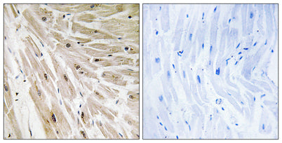 Ribosomal Protein L22 rabbit pAb