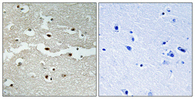 BRCA2 rabbit pAb