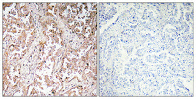 UCP2 rabbit pAb