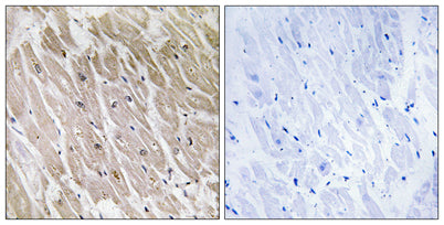ACAD-10 rabbit pAb