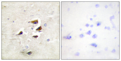 CaMKIIα/β/δ rabbit pAb