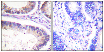 Cbl (phospho Tyr674) rabbit pAb