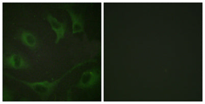 Cbl (phospho Tyr774) rabbit pAb