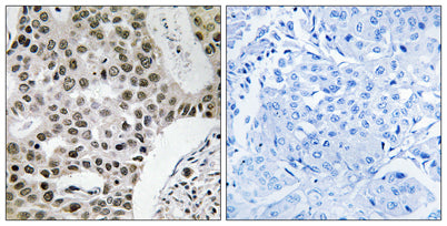 ZNF262 rabbit pAb