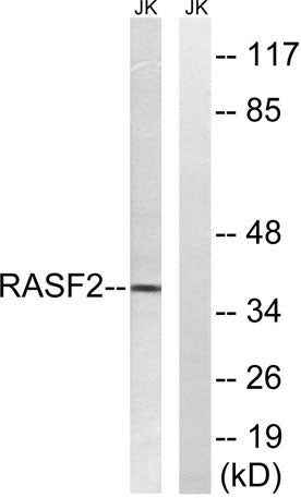 RASSF2 rabbit pAb