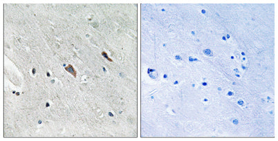 Gab 2 (phospho Tyr643) rabbit pAb