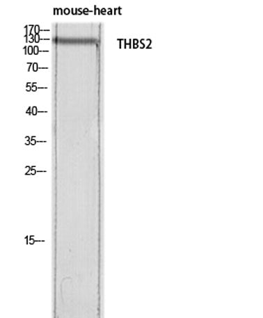 Thrombospondin 2 rabbit pAb