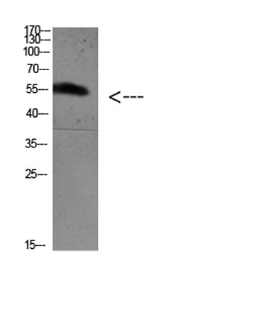 FoxO4 (Acetyl Lys189) rabbit pAb