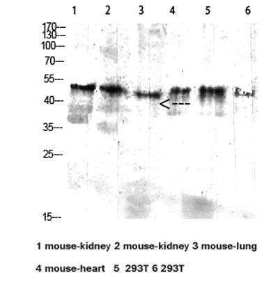 CD64 rabbit pAb
