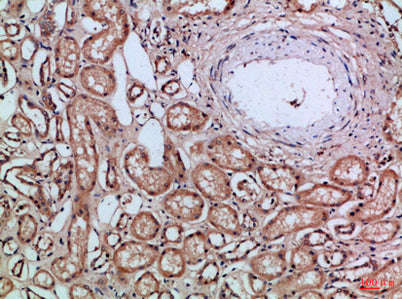 CD66a/b/c rabbit pAb