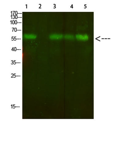 AVP Receptor V2 rabbit pAb