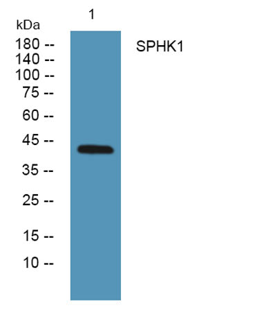 SPHK1 rabbit pAb