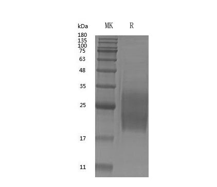 Recombinant Human GM-CSF