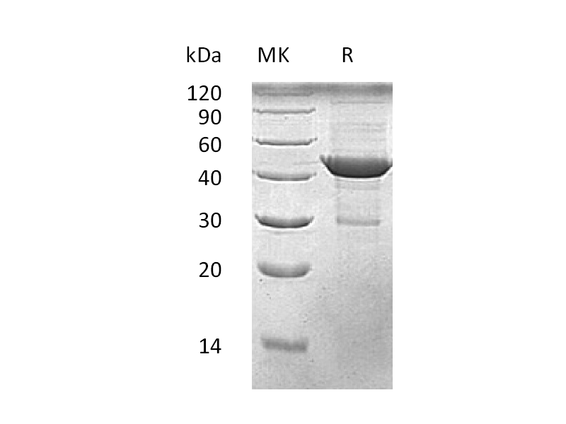 Recombinant Human Beta-Actin (C-6His)