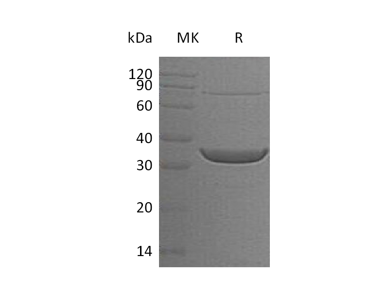 Recombinant Human ACY3 (N-6His)