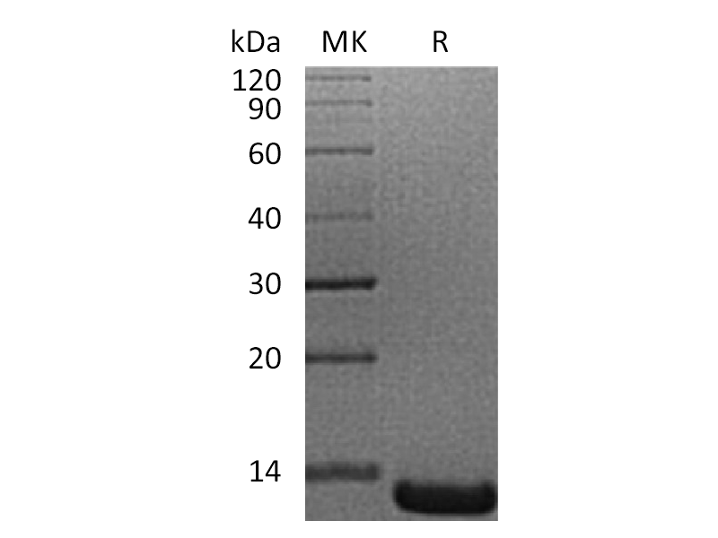 Recombinant Human ACYP1 (N-6His)