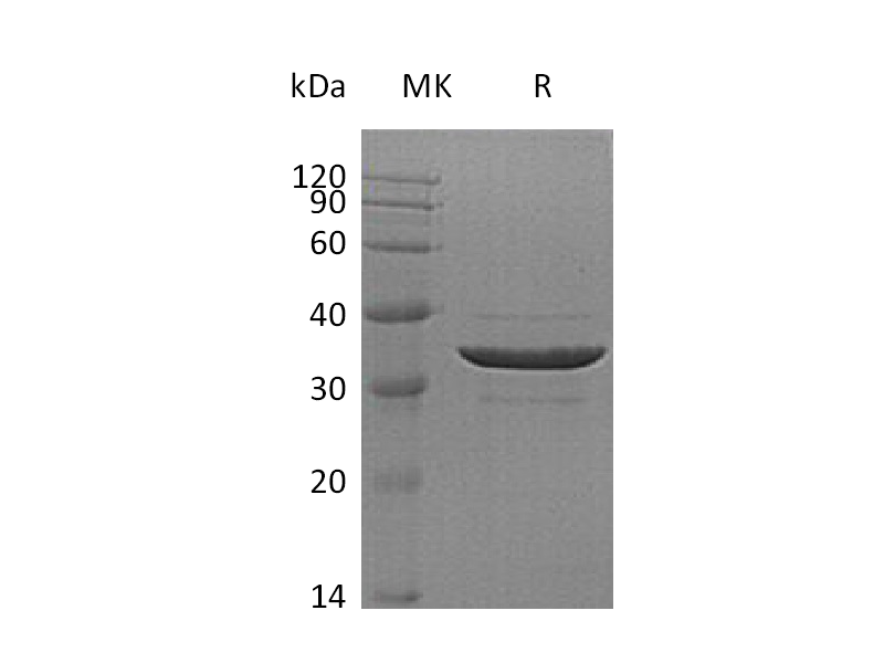 Recombinant Human ACYP2 (N-GST)