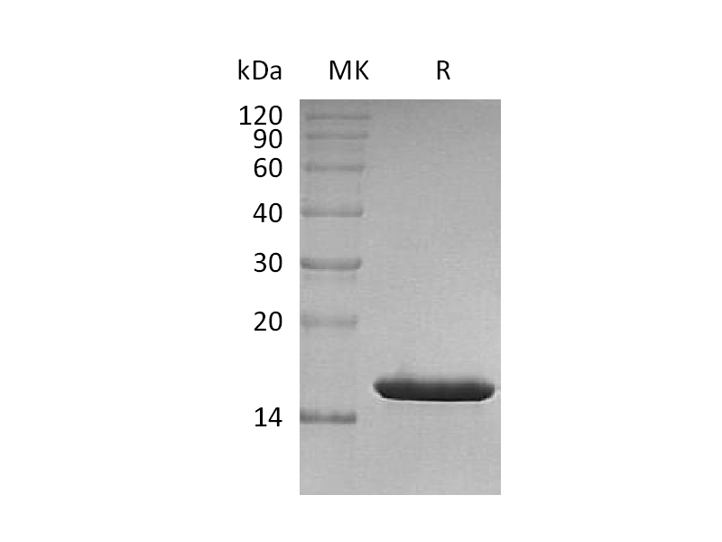 Recombinant Human FABP4 (N-6His)
