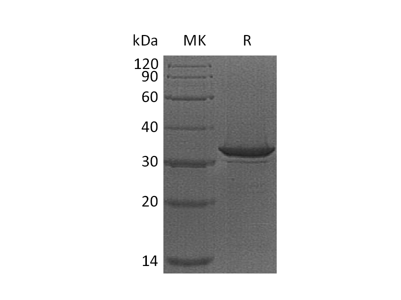 Recombinant Human Haptoglobin (N-6His)